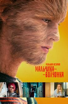 Реальная история мальчика-волчонка Реальная история мальчика-волчонка